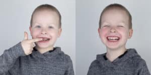 ציפוי שיניים לילדים